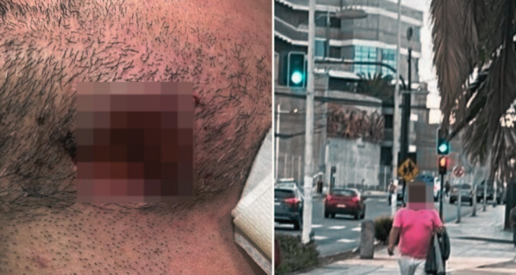 hombre mordió a estudiante en Antofagasta