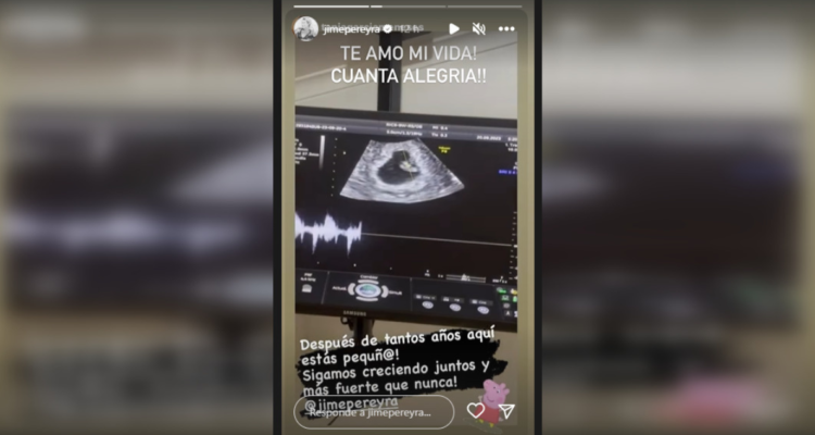 María Jimena Pereyra y su esposa confirman que serán madres