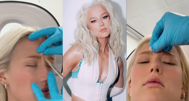 Vesta Lugg contó la verdad sobre sus procedimientos estéticos: “Me pongo botox desde los 23 años”