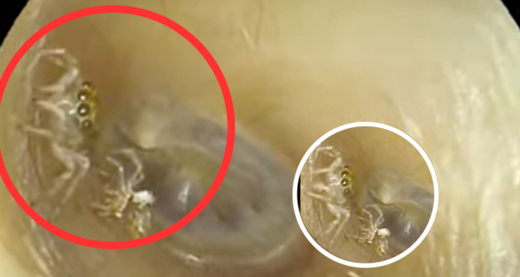 El escalofriante video de una araña al interior del oído de una mujer en Taiwán