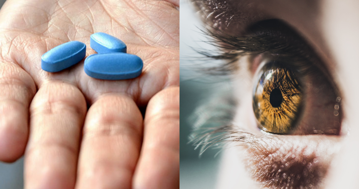 Hombre aseguró perder la visión de un ojo después de consumir alta dosis de viagra