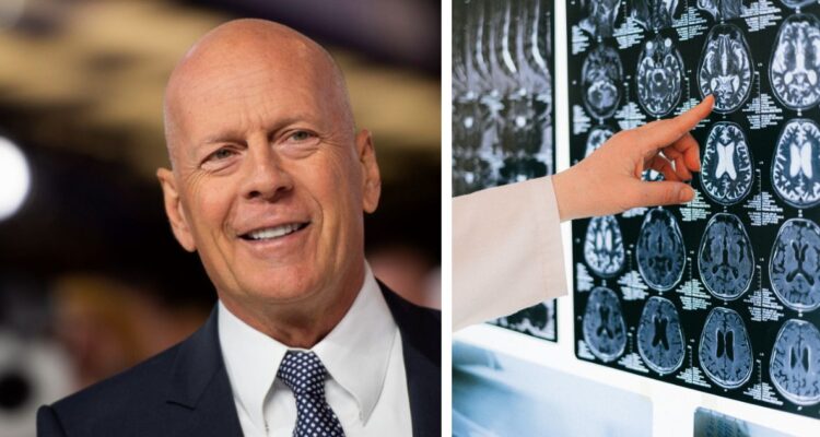 Bruce Willis padece demencia frontotemporal