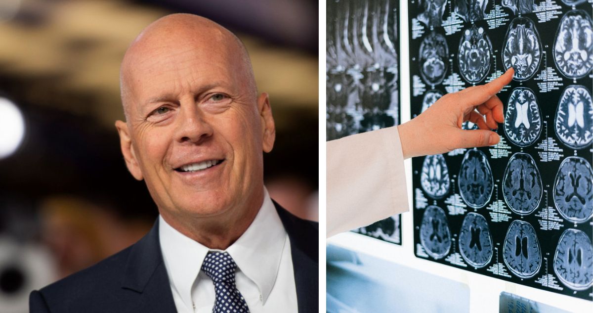 Bruce Willis padece demencia frontotemporal