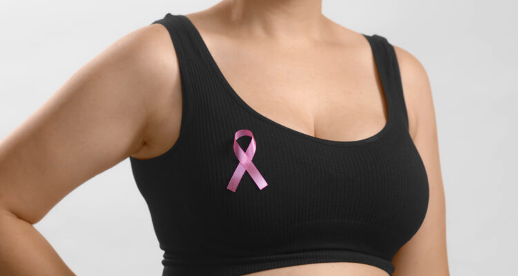 Cáncer de mama