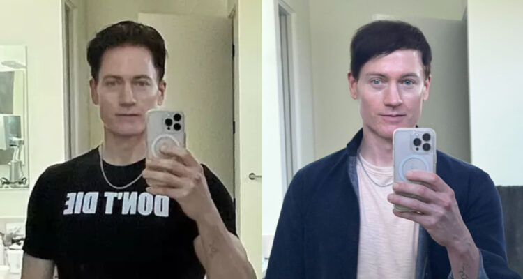 Multimillonario que busca “no morir” mostró cómo rejuveneció su cara en 10 meses: ¿parece de 18 años?