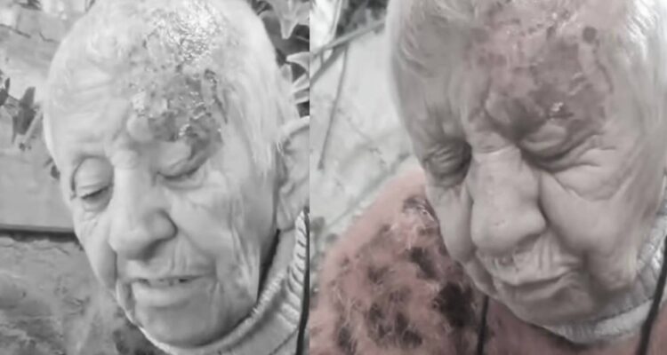 Adulta mayor denuncia que le quemaron el rostro con ácido y que mataron a sus perros en La Florida