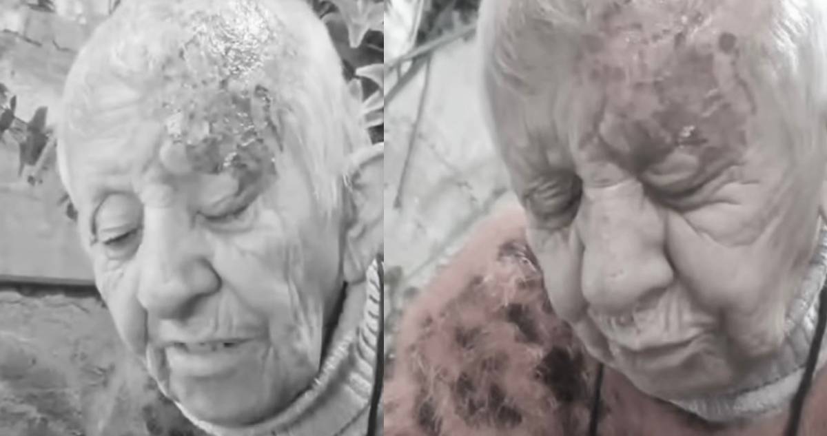 Adulta mayor denuncia que le quemaron el rostro con ácido y que mataron a sus perros en La Florida