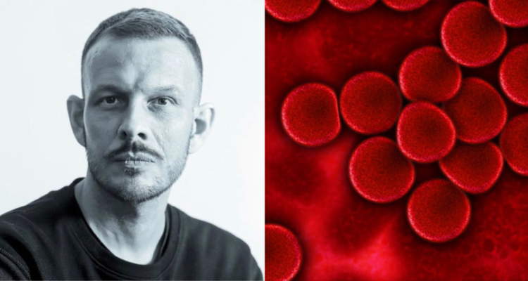 Linfoma no Hodgkin: en qué consiste el tipo de cáncer con el que lidió Luis Larraín