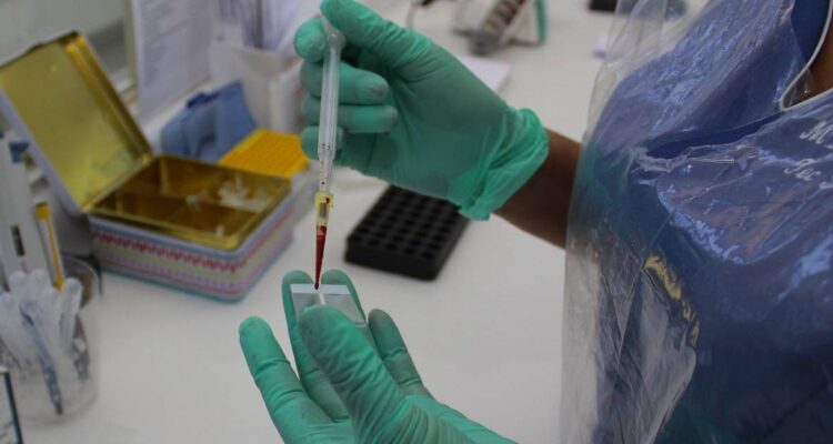 Confirman primer fallecimiento del 2023 por virus Hanta en la RM: recomiendan extremar autocuidado