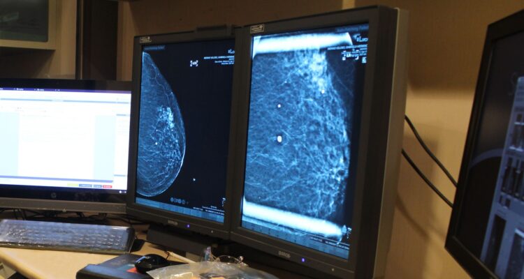 Centro de mamas Hospital Las Higueras