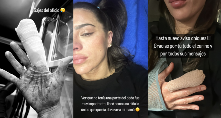 Instagram Stories de Gianella Marengo tras accidente en Top Chef VIP