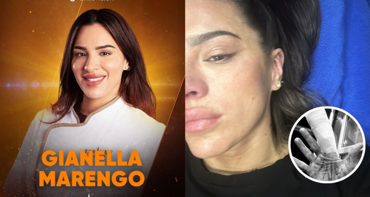 Gianella Marengo en poster oficial de Top Chef VIP (izquierda) y tras accidente en la cocina (derecha)