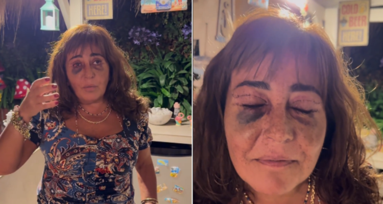Operación de Helhue Sukni
