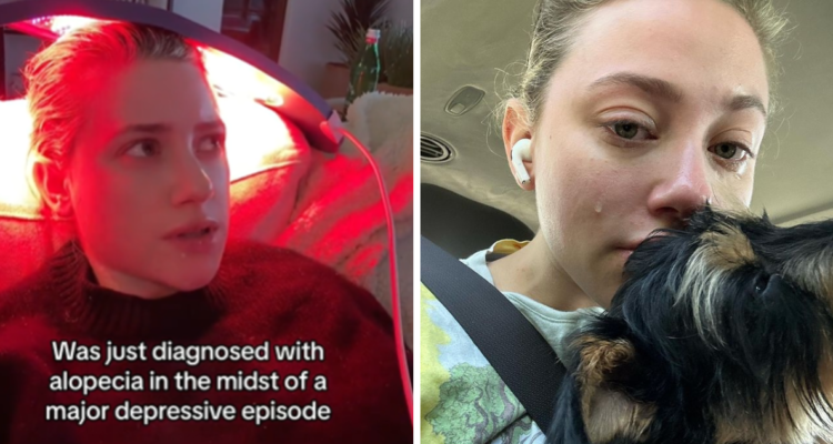 Actriz de Riverdale, Lili Reinhart, revela que le diagnosticaron alopecia tras grave cuadro depresivo