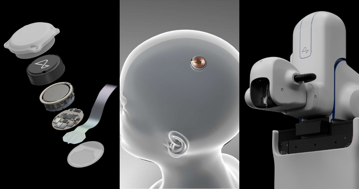 ¿Cómo funciona el implante cerebral de Neuralink que está siendo probado por primera vez en un humano?