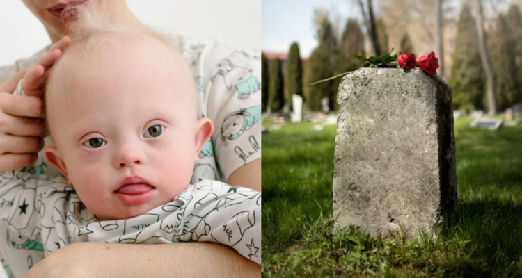 Estudio descubre que bebés con síndrome de Down eran enterrados de forma especial en la Edad de Hierro