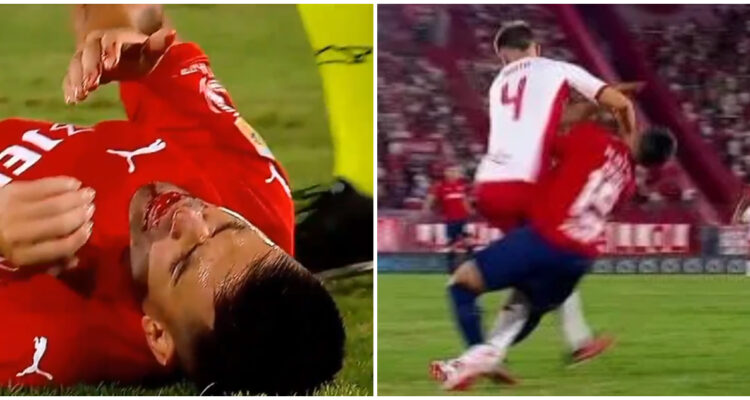 codazo Independiente Huracán ex Colo Colo Damián Pérez