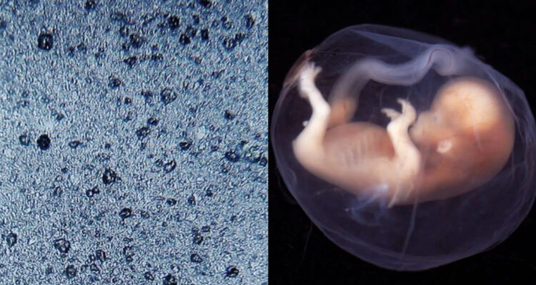 Un nuevo estudio de placentas humanas encontró microplásticos en cada una de las muestras analizadas