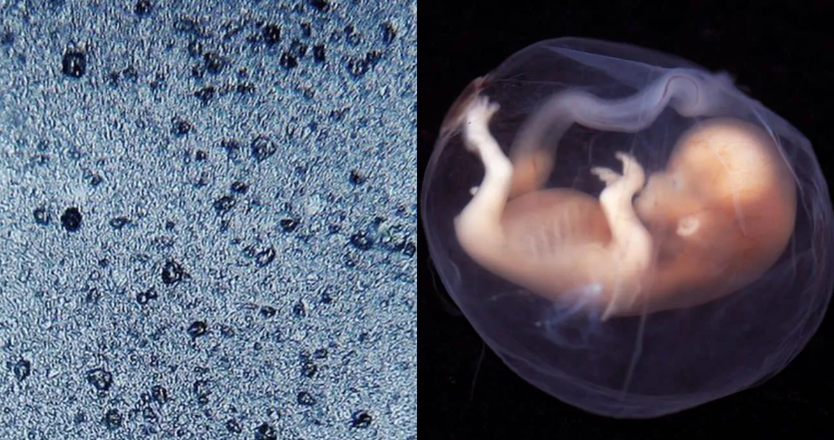 Un nuevo estudio de placentas humanas encontró microplásticos en cada una de las muestras analizadas
