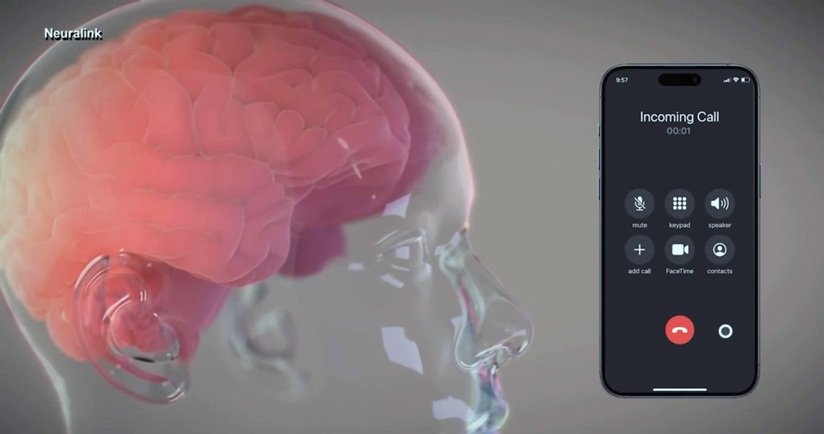 El dueño de Neuralink anunció el éxito de un implante para usar dispositivos con el pensamiento. El maltrato animal es uno de los temas.