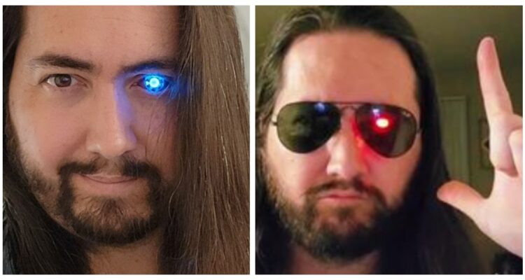 La vida de Brian cambió para siempre cuando perdió su ojo, pero no permitió que eso lo detuviera y lo reemplazó por uno biónico.