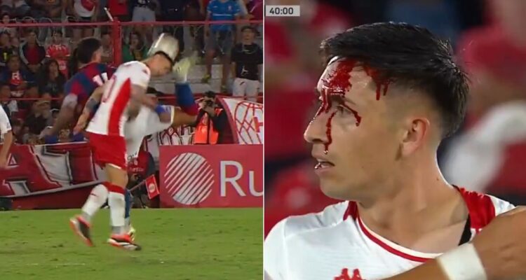 Terminó con el rostro lleno de sangre: Rodrigo Echeverría recibió una brutal patada en Argentina