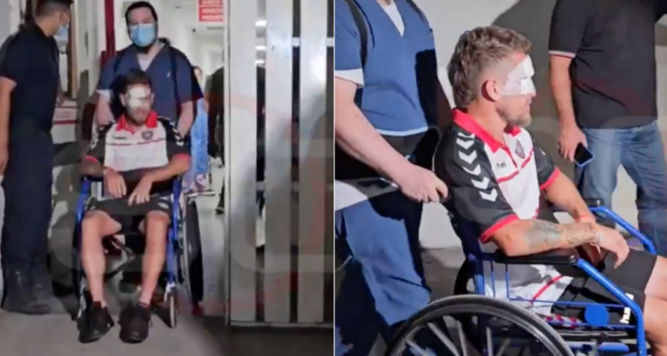 Así le quedó el rostro a jugador agredido con una botella en la cara en Argentina.