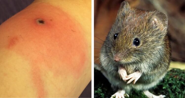 Qué es el virus Alaskapox o viruela de Alaska que sería contagiado por ratones y por el cual ya se registra una muerte en Estados Unidos.