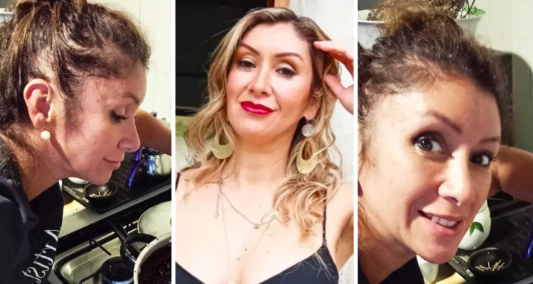 Angélica Sepúlveda se sincera respecto a su alopecia con emotiva reflexión: “Me olvidé y me acepté”