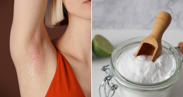 El uso excesivo de bicarbonato en el cuerpo traería consecuencias negativas para la piel.
