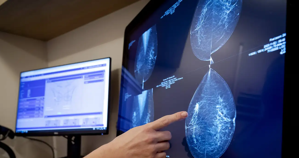 Se espera que esta tecnología pueda integrarse en el futuro a la detección y crecimiento tumoral de cáncer de mama en tiempo real.