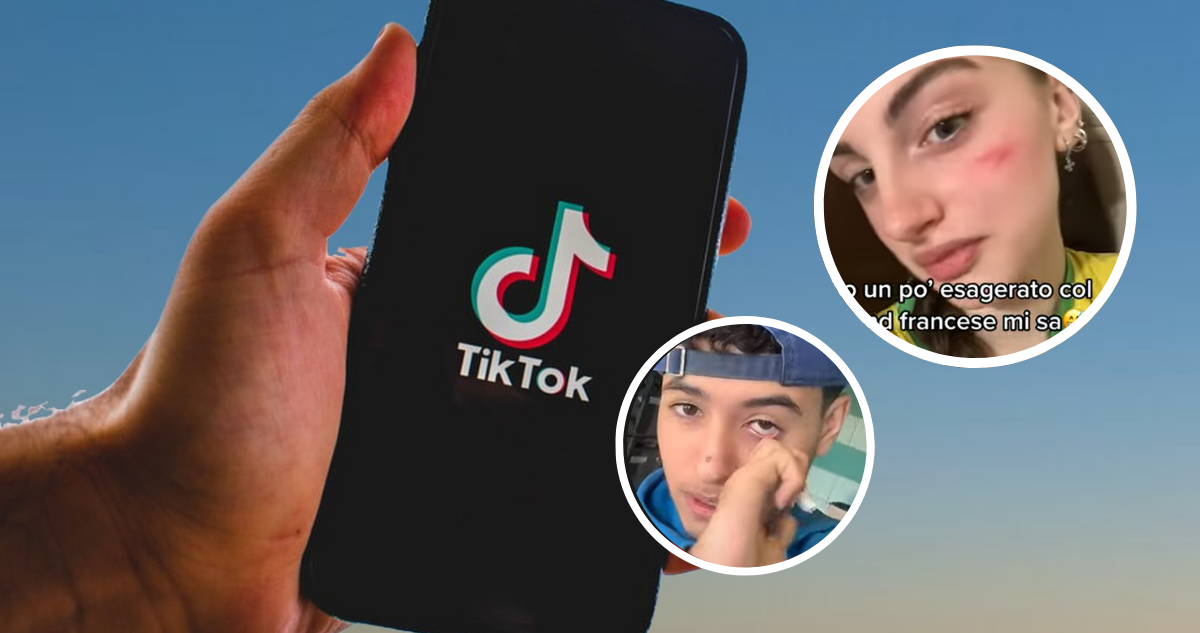 Italia multa con más de 10 millones de euros a TikTok por reto viral de la “cicatriz francesa”