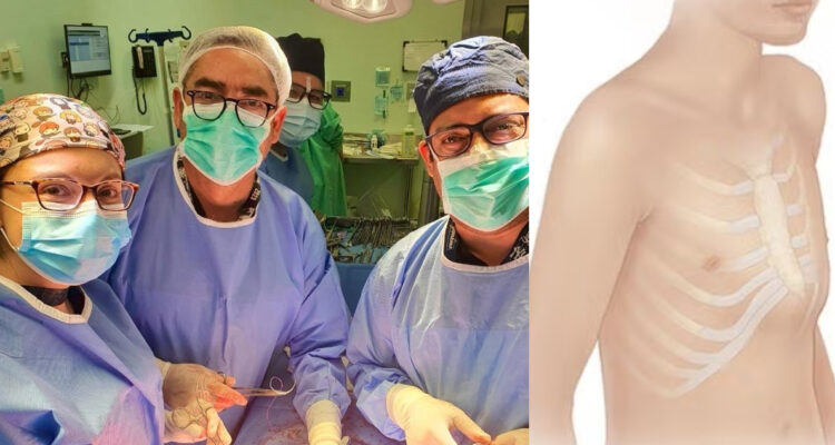 Realizan la primera cirugía para corregir un caso de “pecho de paloma” en Chile: ¿De qué se trata?