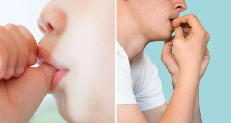 Ciertos factores podría provocar que los dientes cambiaran su posición con el paso del tiempo. No solo tiene relación con la genética o con lo que comemos, sino que también con los malos hábitos.