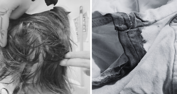 “Tenía sangre en la cabeza”: mujer denuncia agresión de funcionaria a su hija en escuela de Osorno