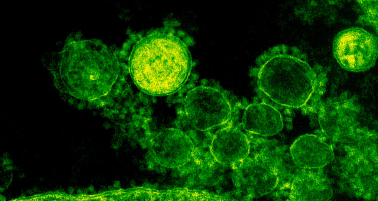 El calentamiento global está descongelando virus prehistóricos que aún son infecciosos, dicen expertos