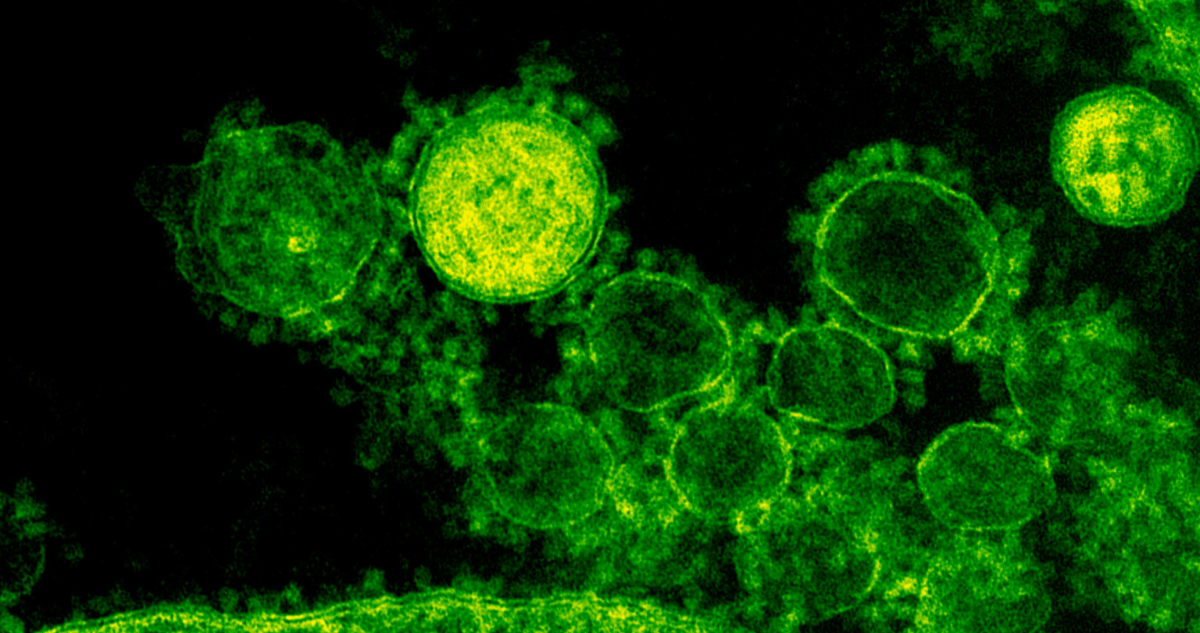 El calentamiento global está descongelando virus prehistóricos que aún son infecciosos, dicen expertos