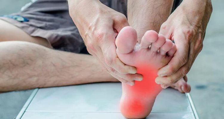 Tener hongos en los pies es una situación médica común, que muchas veces se da por un problema de higiene, por el tipo de calzado o por tocar zonas contaminadas.