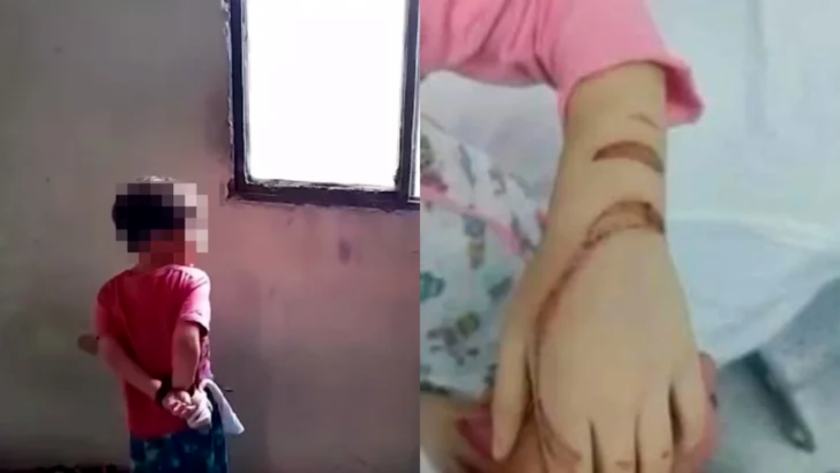 Niño amarrado de pies y manos, además quemado por su padrastro, muestra el maltrato físico