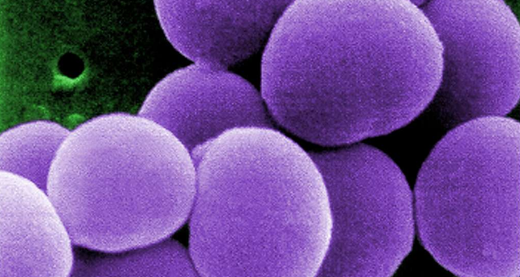Los casos de STSS, una infección bacteriana poco común pero grave alcanzó la cifra récord de 941 en Japón el año pasado.