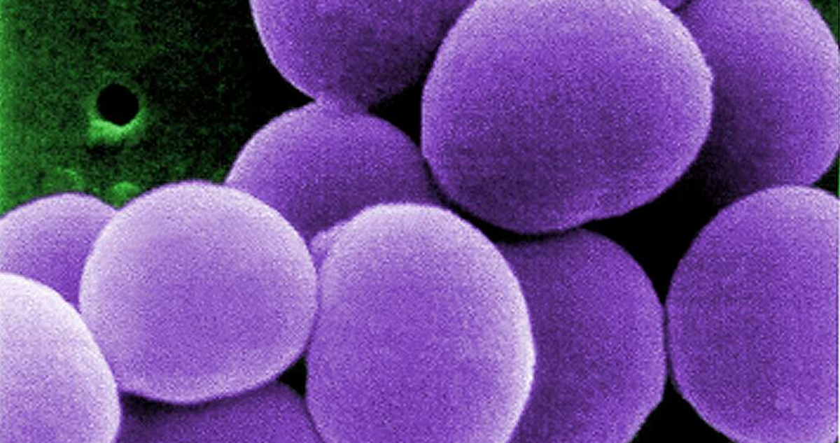 Los casos de STSS, una infección bacteriana poco común pero grave alcanzó la cifra récord de 941 en Japón el año pasado.
