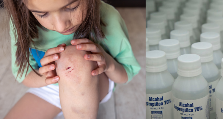 limpiar heridas con alcohol