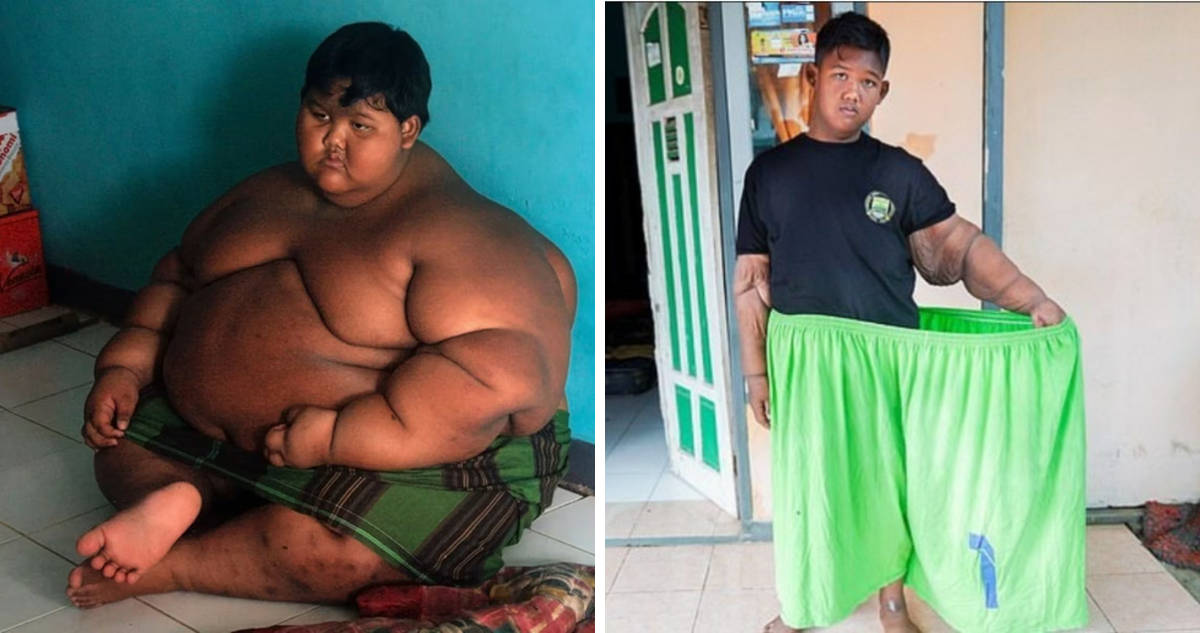 Arya Permana fue considerado el niño más gordo del mundo, luego de que a sus 9 años pesara 190 kilos. Actualmente, gracias a un nuevo estilo de vida y hábitos, su cambio es considerable.