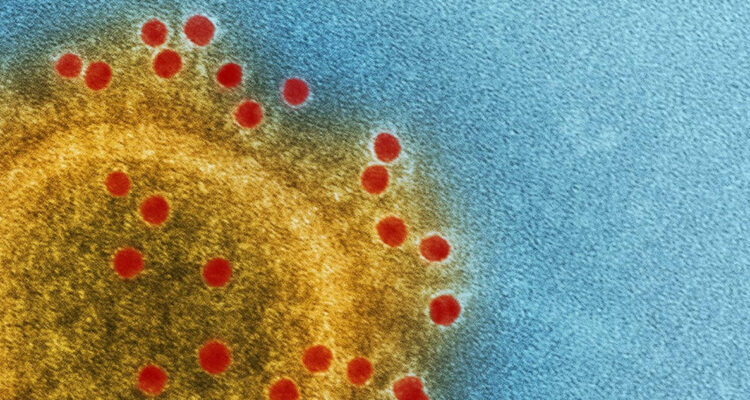 Científicos descubren una bacteria mutante al interior de la Estación Espacial Internacional (EEI)