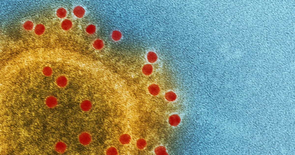 Científicos descubren una bacteria mutante al interior de la Estación Espacial Internacional (EEI)