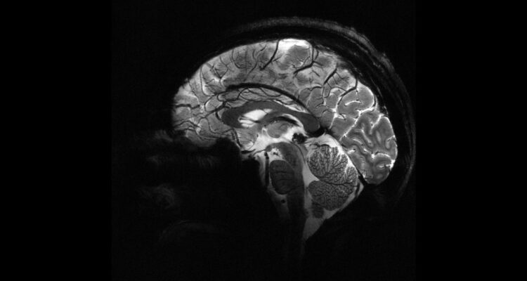 Primeras imágenes del cerebro tomadas con el escáner de resonancia magnética más potente del mundo