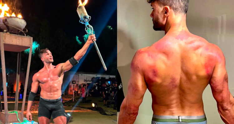 Fabio Agostini mostró heridas que le quedaron tras prueba final de Tierra Brava: “Me costó dormir”