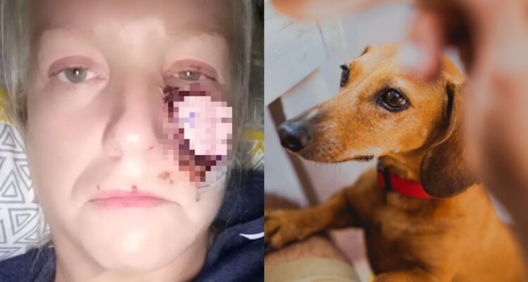Reportan brutal ataque de perro salchicha: le arrancó la mejilla a una mujer y se la comió