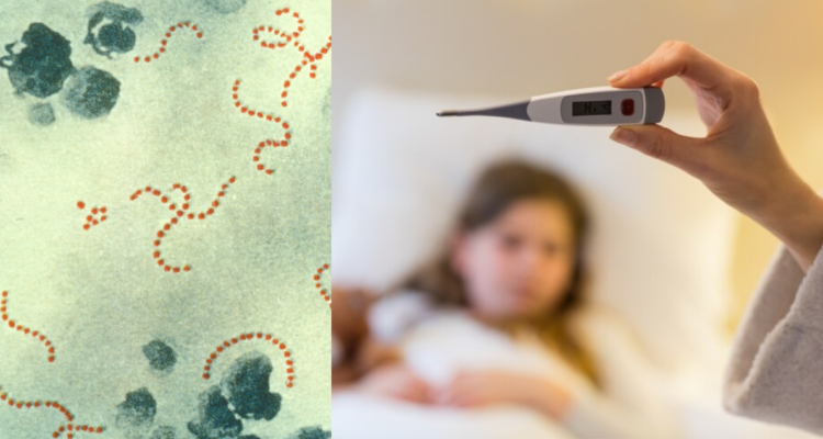 Streptococcus pyogenes