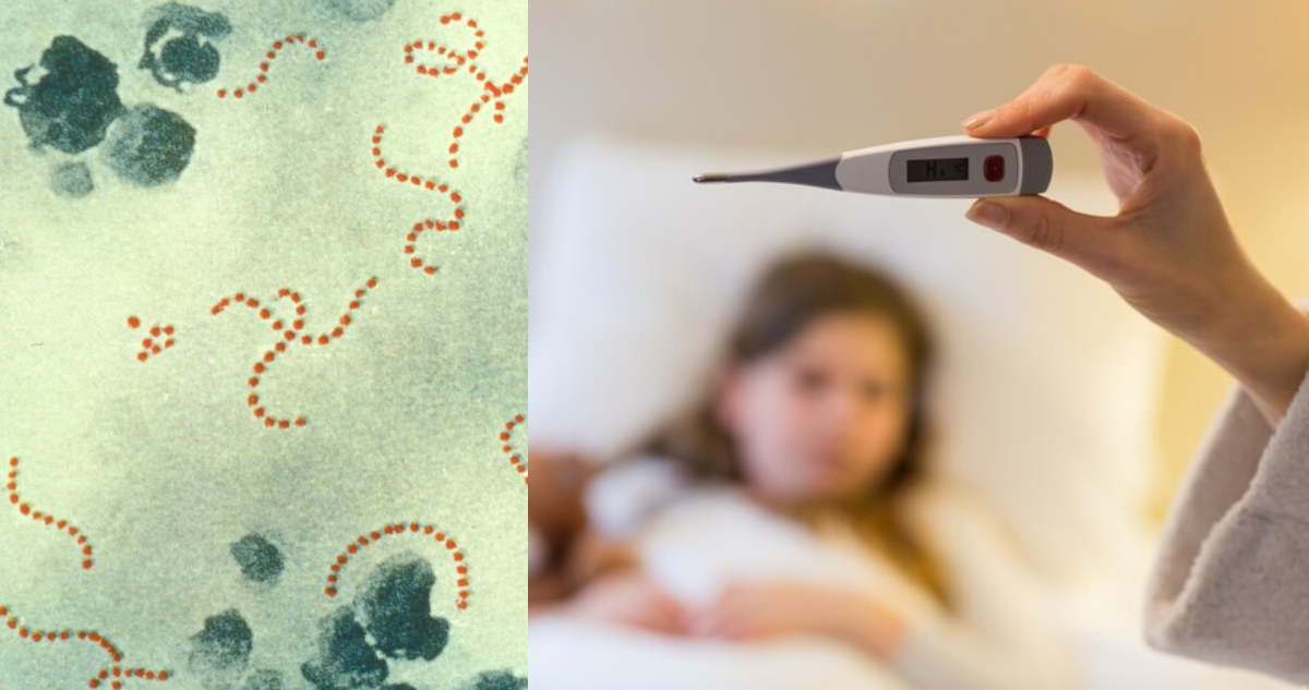 Streptococcus pyogenes